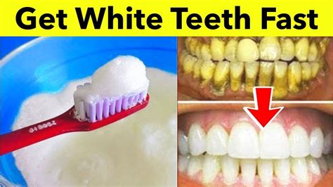 Magic white teeth whitening